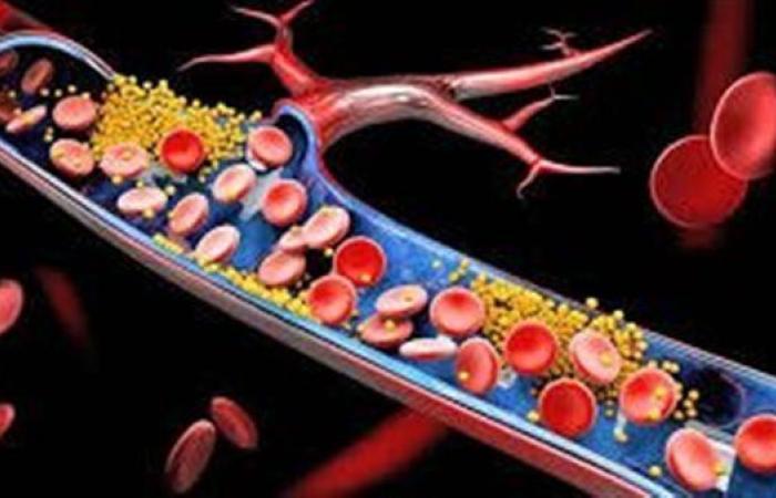 بالبلدي : ارتفاع الكوليسترول السيئ بسبب نقص هذا الفيتامين.. تعرف على فوائده ومصادره الغذائية